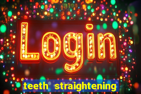 teeth straightening los altos