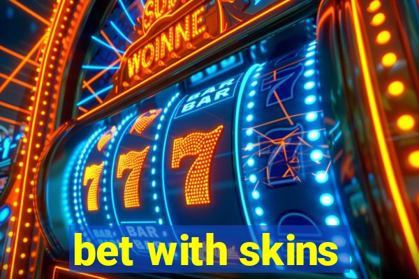 bet with skins