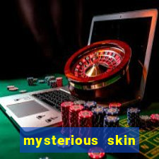 mysterious skin assistir online dublado