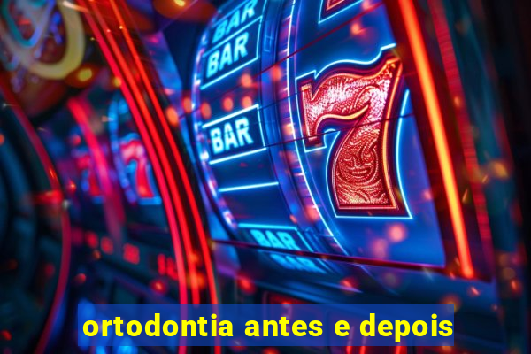 ortodontia antes e depois