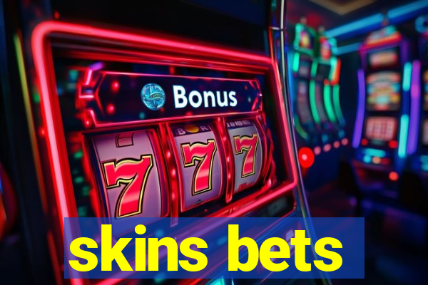 skins bets