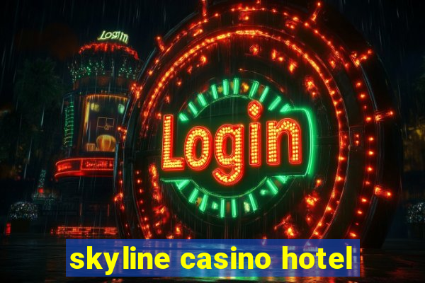 skyline casino hotel