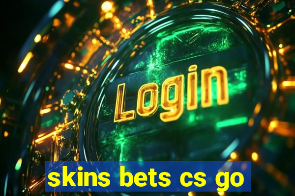 skins bets cs go